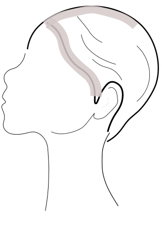 白髪の分け目・Tゾーン